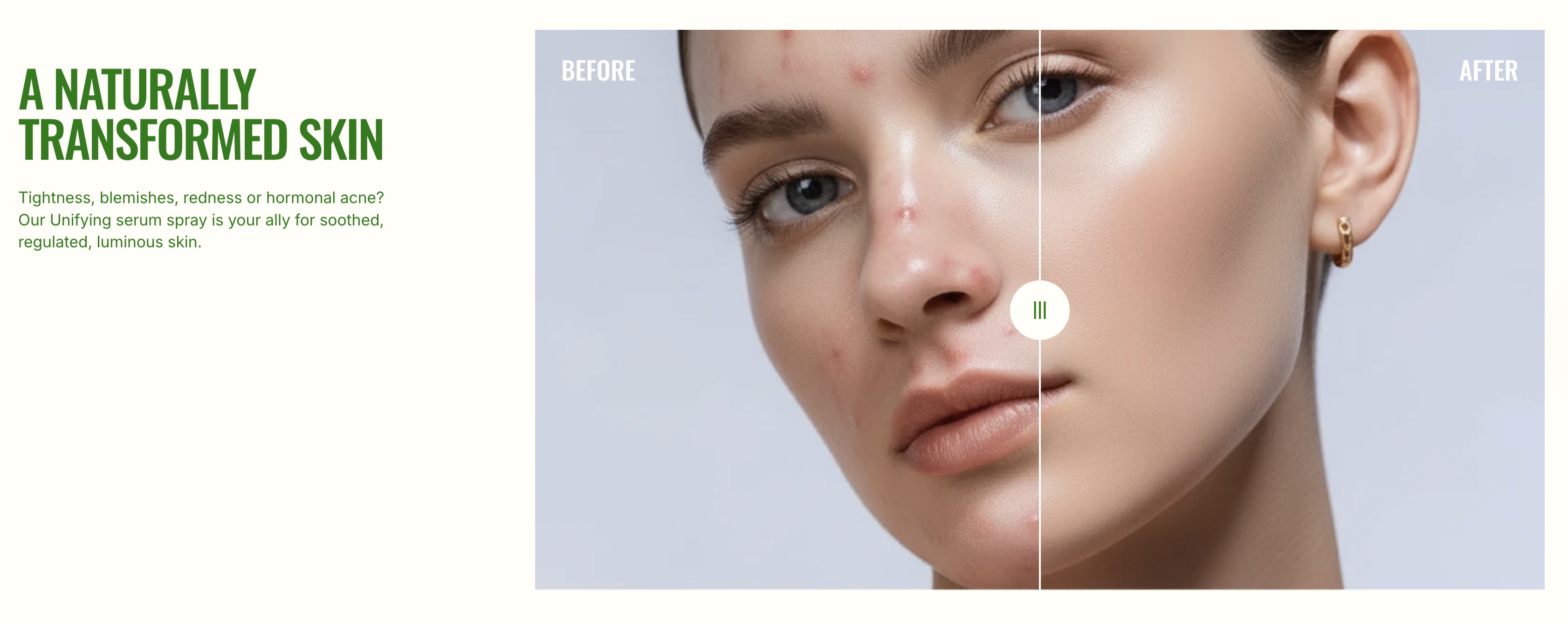 Image comparison